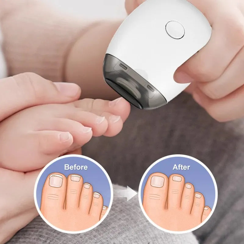 Electric Nail Trimmer Rechargeable Pain-Free Technology Automatic Fingernail & Toenail Clipper with LED Light Grinding Head Port